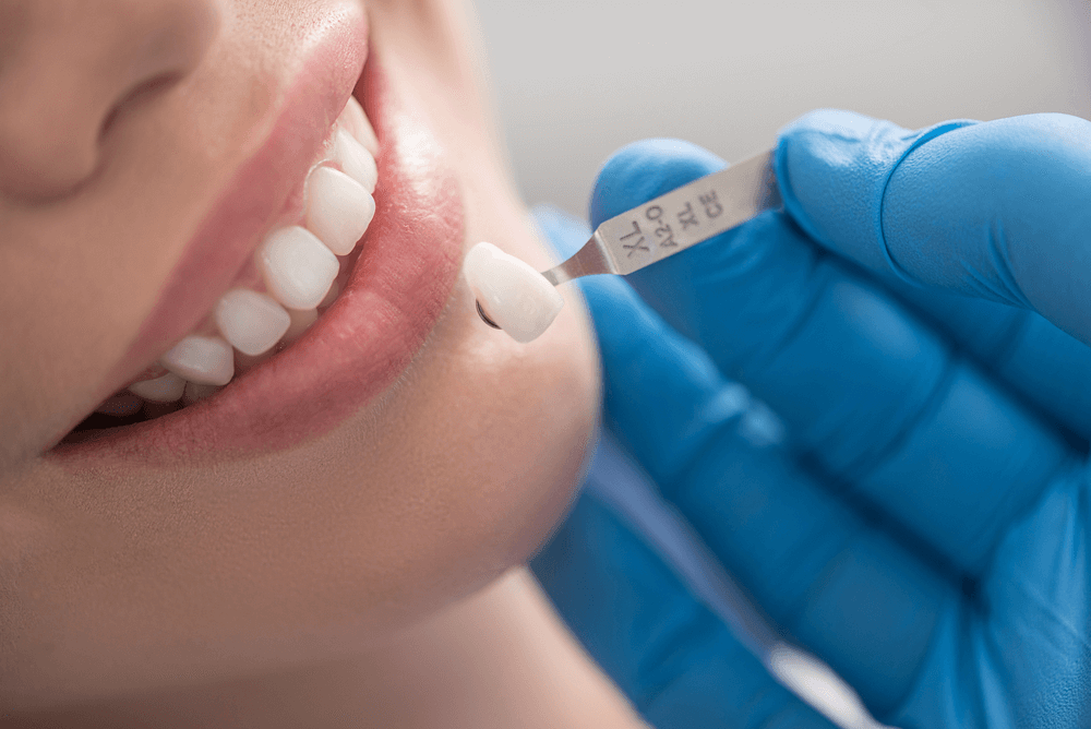 What is Dental Treatment?